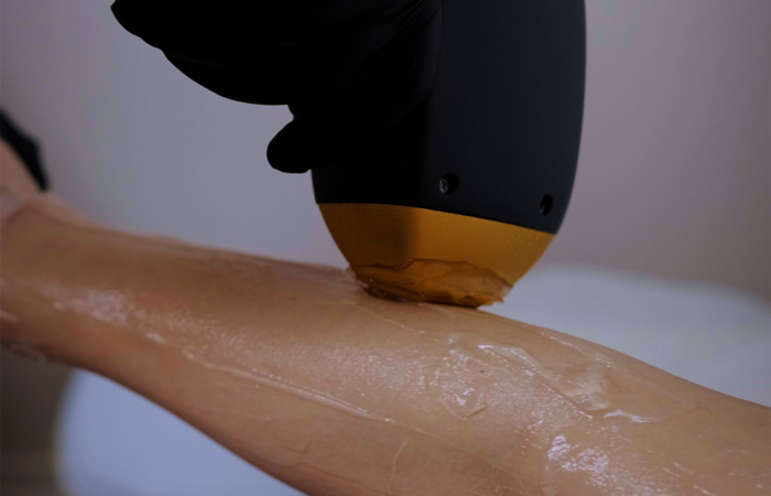 Buz Lazer Epilasyon Sima Güzellik Salonu